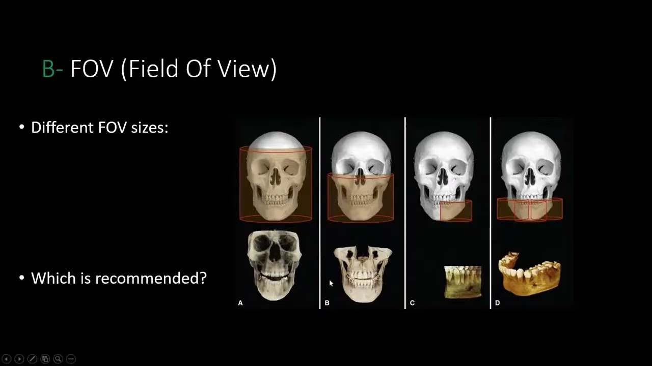 Στιγμιότυπο από το μάθημα: Έλεγχος CBCT πριν τον σχεδιασμό